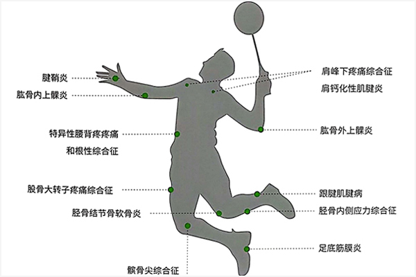 从腱鞘炎到骨不连：康正冲击波治疗仪以更广适应症，深度覆盖临床需求！