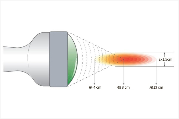 一文了解 “发散冲击波治疗仪”和“电磁聚焦冲击波治疗仪”的区别